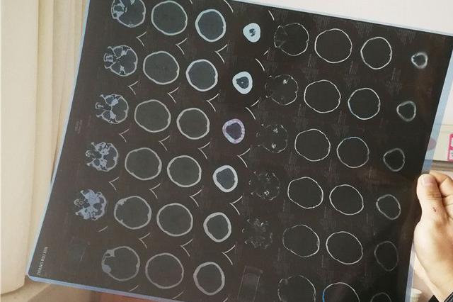 西安一高层起火物业疏散住户 租客:刷完牙再走