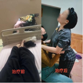 患者术后恢复状态