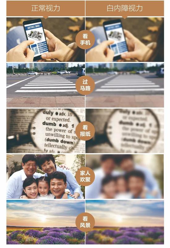 白内障,这么多年原来我们都想错了新浪陕西健康频道 2020-05-06 11