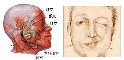 fZcM-fzcyxmv0494794.jpg