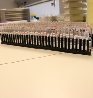 丹麦生物样本库:流行病学家梦之地