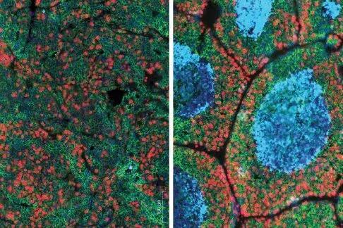 敲除CD4+T细胞中TGF-β受体后，小鼠肿瘤细胞死亡（右图蓝色部分）