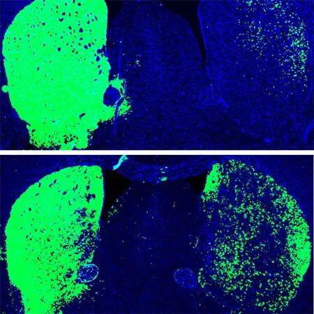 反义寡核苷酸治疗之后，小鼠的多巴胺神经元（绿色）增加 | UC San Diego Health Sciences