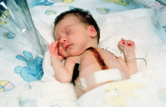 手术成功后安然入睡的