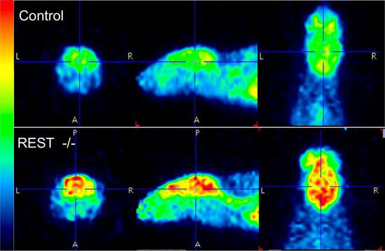 缺乏REST蛋白质的小鼠（下）显示出比正常小鼠（上）更强的大脑神经活动（红色）。| 图片来源：Yankner实验室 / 《自然》
