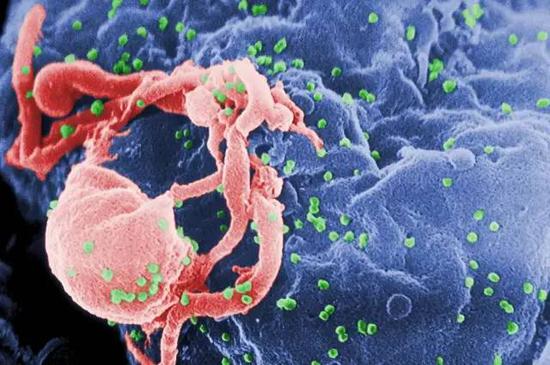 ▲活跃的HIV-1病毒（绿色）正源源不断从培养的免疫细胞中冒出（图片来源：Photo Credit： C。 GoldsmithContent Providers： CDC/ C。 Goldsmith， P。 Feorino， E。 L。 Palmer， W。 R。 McManus [Public domain]）