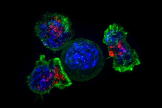 Killer T cells surround a cancer cell。 Credit： NIH
