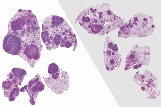 图：给小鼠使用抗生素后（右），肺部肿瘤（紫色部分）明显缩小 （图片来源：参考资料[2]，作者 Chengcheng Jin）