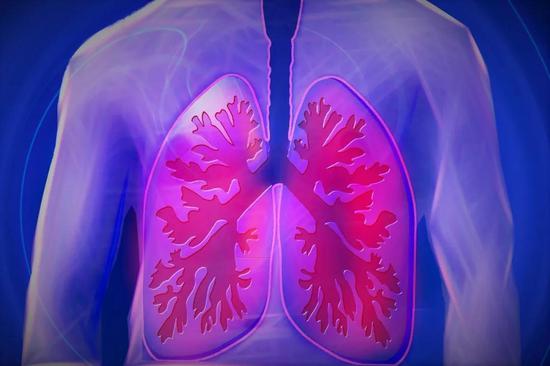 ▲目前已有三款免疫疗法获批治疗小细胞肺癌，分别是百时美施贵宝的Opdivo、默沙东的Keytruda、罗氏的Tecentriq（图片来源：Pixabay）