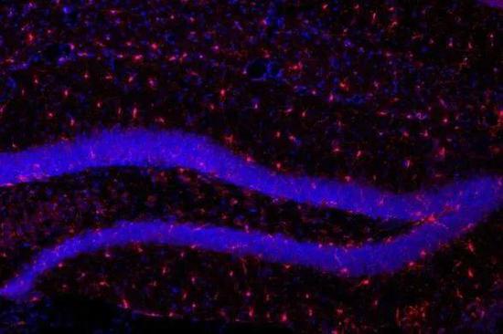 有没有发现最近老是健忘？可能正被免疫细胞吞噬