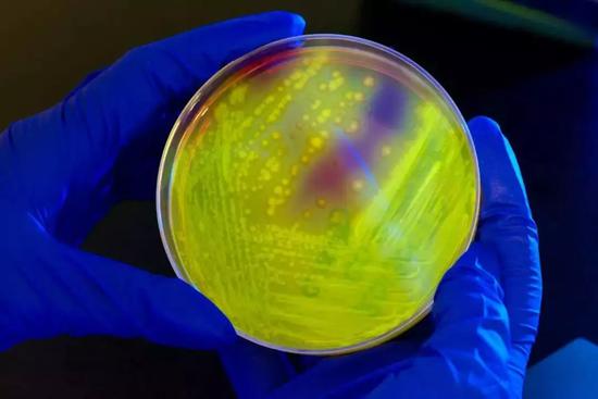 图 | 培养皿中的艰难梭菌，在长波紫外线下发光。（来源：MIT Technology Review）