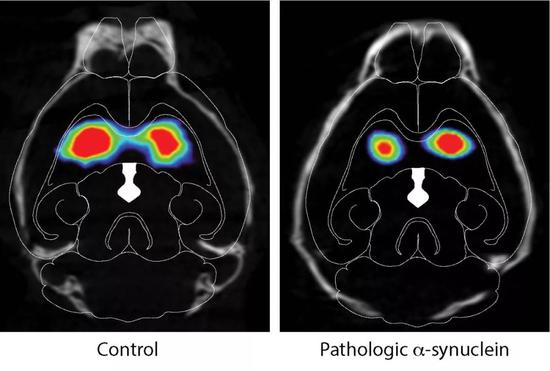 脑成像显示，胃肠道注射病理蛋白后，小鼠大脑内多巴胺系统受损（图片来源：参考资料[1]）