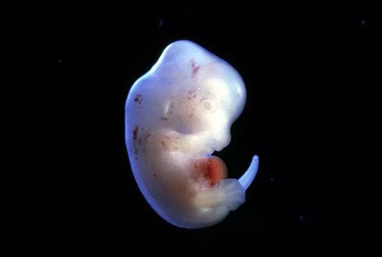 大鼠胚胎（图片来源：Science Pictures ltd/SPL）