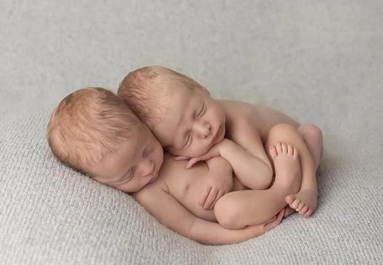 双胞胎胞胎（图片来源：百度图片）