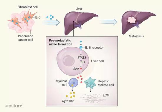 流浪癌细胞为何喜欢肝？胰腺癌癌细胞肝脏