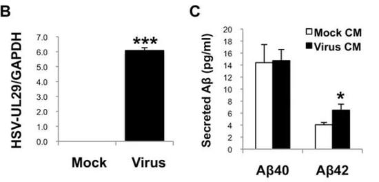 HSV-1导致β淀粉样蛋白原纤维的出现