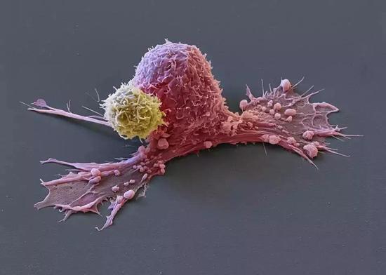 免疫细胞大战癌细胞