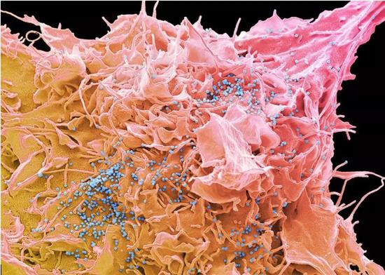  图片中的蓝色颗粒为 HIV 病毒