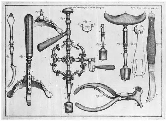 1786年的意大利插画展示的是用于颅骨穿孔手术的工具