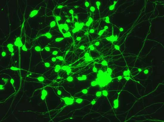 图3。 Marius Wernig团队获得的诱导神经细胞（Credit： Marius Wernig， CC BY-ND）