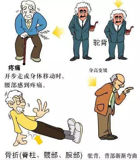  图1 骨质疏松患者症状（图片来源自网络）