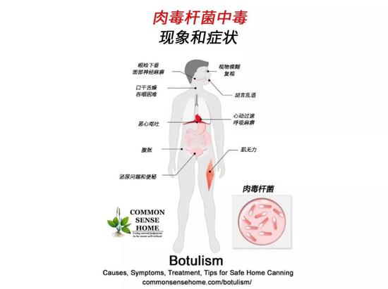 肉毒素中毒的现象（图片来源：commonsensehome.com/botulism/）