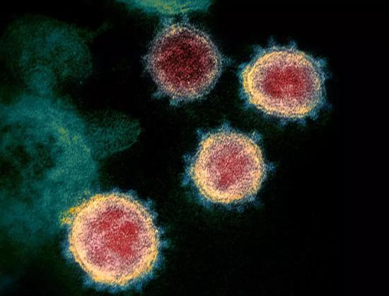 新冠病毒S蛋白与细胞ACE2亲和力是SARS的10到20倍白细胞新冠肺炎