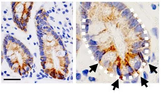 ▲生成酮体的酶（褐色）在人的肠道干细胞中大量表达（图片来源：参考资料[1]）