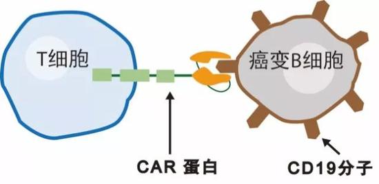 CAR-T疗法的一个原理说明图