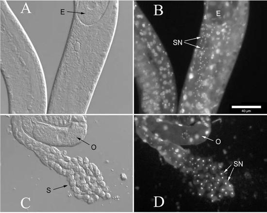 某种Panagrolaimus属内的线虫。该属线虫一般直径约50微米，图中的S代表精子，E为卵，O为卵母细胞。图片来源：参考文献2