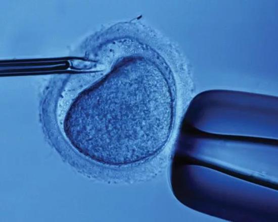 试管婴儿患高血压的风险竟是普通人的6倍！试管婴儿血管高血压