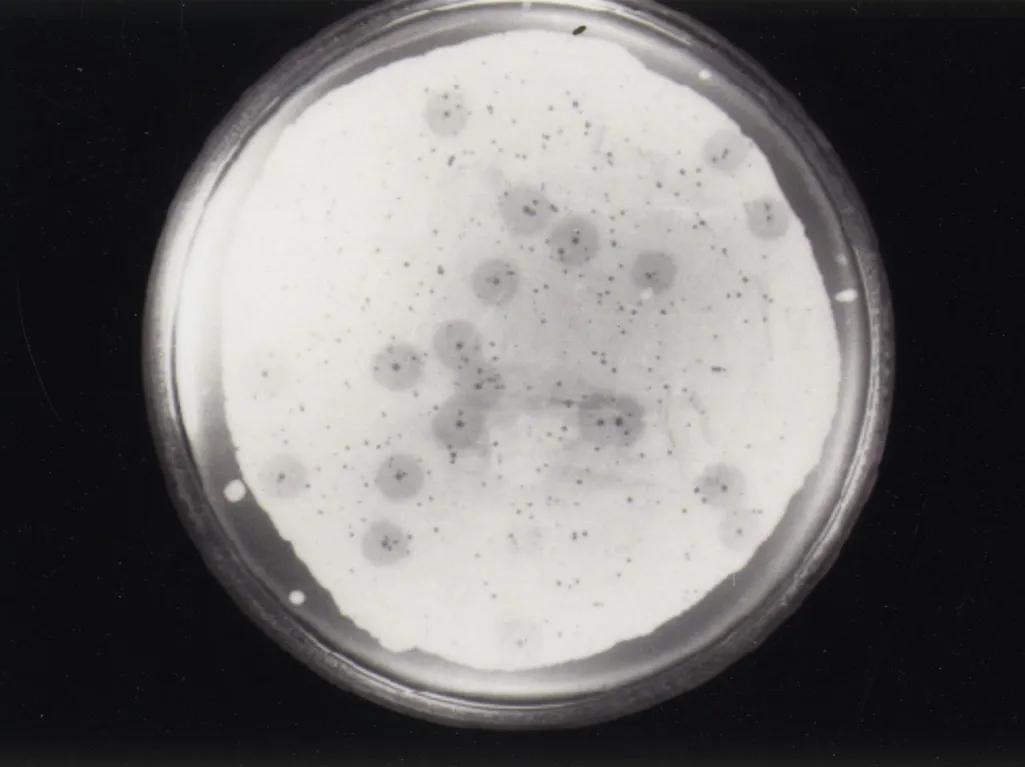 20世纪30年代迪海莱实验室的培养皿之一，噬菌体杀死细菌形成的空白圆点清晰可见。（图片来源：巴斯德研究所/费利克斯·迪海莱档案馆）