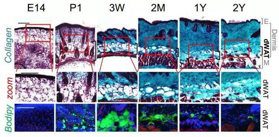  分别为胚胎14天、出生1天、3周、2个月、1年、2年的小鼠真皮特征，绿色标记为脂质，小鼠出生3周真皮脂肪细胞发育成熟，之后逐渐减少