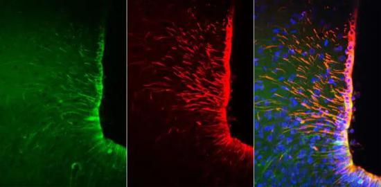 ▲沿着脑室边缘排列的一些伸展细胞（红色标记）中有一些表达了光敏感离子通道（绿色），可以被光照激活（图片来源：参考资料[2]；Credit： University of Warwick）