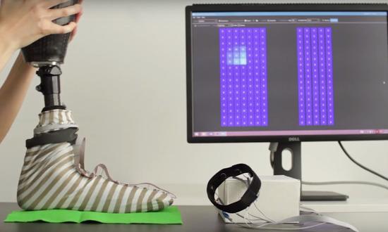 奥地利研究人员开发智能袜子proCover，可以让假肢感受知觉