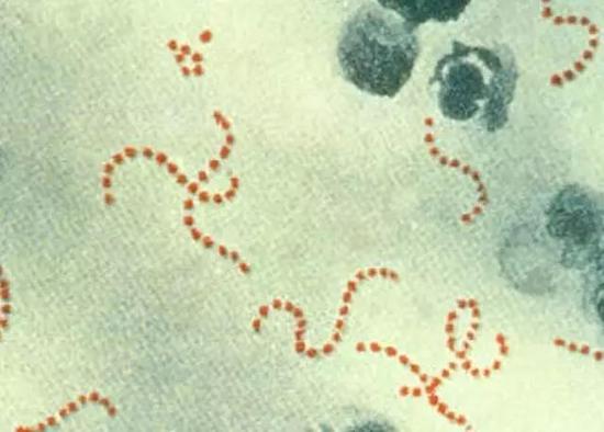 螺旋锥蝇:五种噬肉生物都是怎么整死人的? 化脓性链球菌的显微照片。图源:美国疾病控制与预防中心