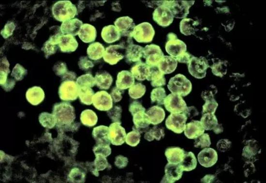 螺旋锥蝇:五种噬肉生物都是怎么整死人的? 图为显微镜下观察到的、经荧光抗体染色的福氏内格里阿米巴原虫。图源:美国疾病控制与预防中心