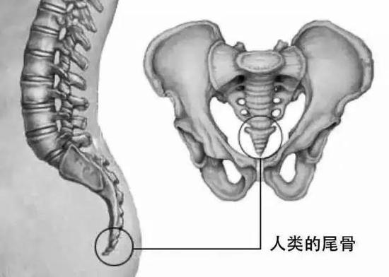 苗勒管永存综合征