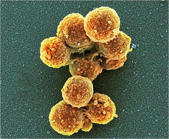 薛定谔的细菌:微生物能否处于量子叠加状态?图片来源:Thomas Deerinck, NCMIR/Science Photo Library
