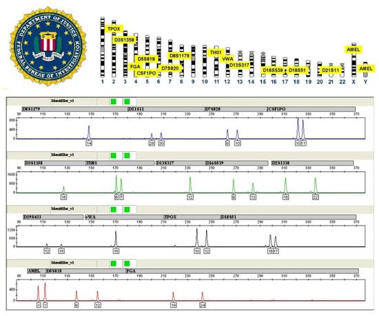 上:美国联邦调查局推荐使用的STR位点(Combined DNA Index System,CODIS)。下:一个典型的STR分析图谱(图片来源:维基百科)。
