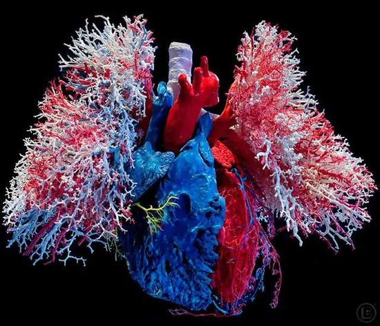 心肺的血管铸形