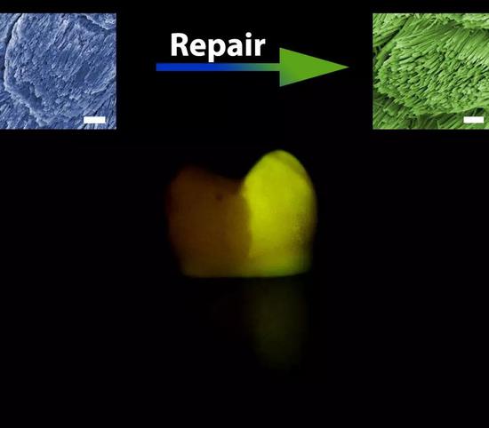 单颗人牙的照片。左边黑色区域为未修复的牙，右侧黄绿色区域为用我们材料修复后的人牙（颜色是由荧光标记物产生，用于区分两个区域）。两张插入图是修复前后的牙釉质扫描电镜图，白色标尺为1微米。