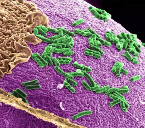 图 | 肠道微生物群落变化与多种疾病相关（来源：MIT Technology Review）