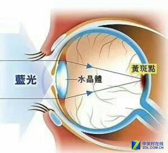 伤害视力的根源其实是蓝光...