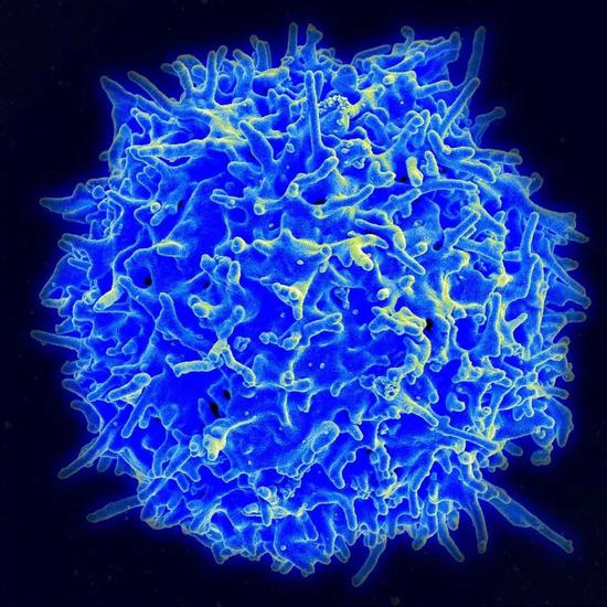 淋巴T细胞电镜扫描图 | NIAID/NIH
