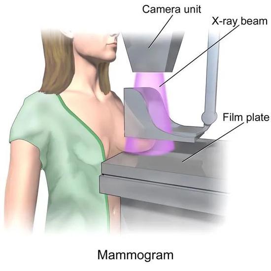 乳房造影术拯救了很多生命，但并不是每个年龄段的女性都推荐做这项筛查丨Wikipedia，上传者BruceBlaus