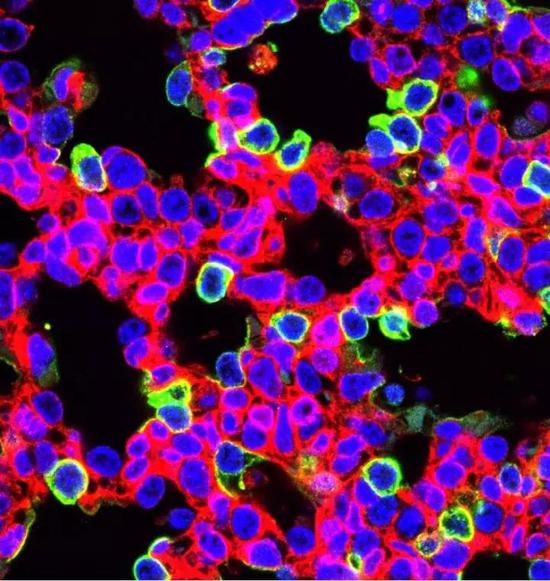  ▲研究人员们在肺部看到了预示基因编辑成功的绿色荧光（图片来源：Penn Medicine）