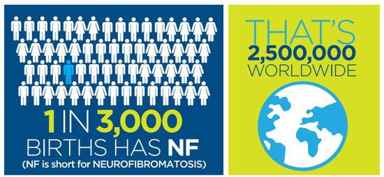 每3000名新生儿里，就有1名神经纤维瘤病患者（图片来源：儿童肿瘤基金会授权使用）