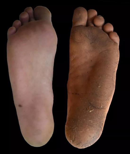 ▲惯于穿鞋的脚（左）和惯于赤足的脚（右）（图片来源：Daniel Lieberman）