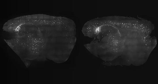 ▲声音和光的双重作用下（左），小鼠脑中的β淀粉样蛋白相较对照组（右）有明显减少（图片来源：Gabrielle T。 Drummond）